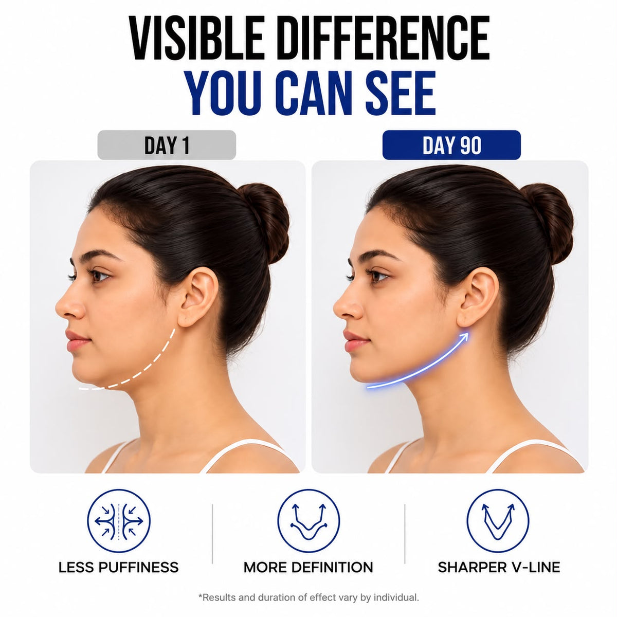 FaceLift Pro™ V-Shaped Slimming Face Belt